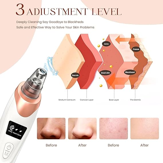 Blackhead Remover Vacuum
