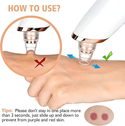 Blackhead Remover Vacuum