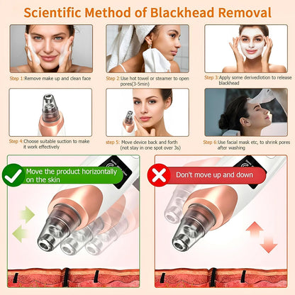 Blackhead Remover Vacuum